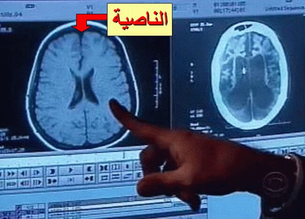 11557alsh3er.JPG