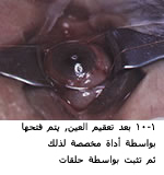 25485alsh3er.jpg