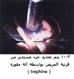 25487alsh3er.jpg
