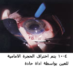 25488alsh3er.jpg