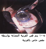 25489alsh3er.jpg