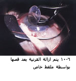 25490alsh3er.jpg