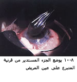 25492alsh3er.jpg