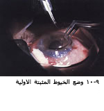 25493alsh3er.jpg