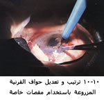 25494alsh3er.jpg
