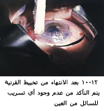 25496alsh3er.jpg
