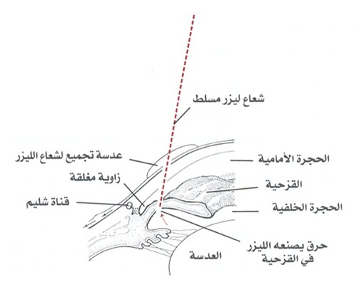 25514alsh3er.jpg