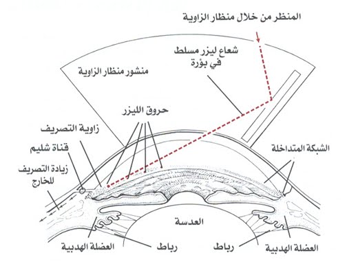 25515alsh3er.jpg