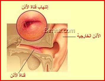 28134alsh3er.jpg