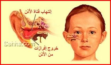 28135alsh3er.jpg