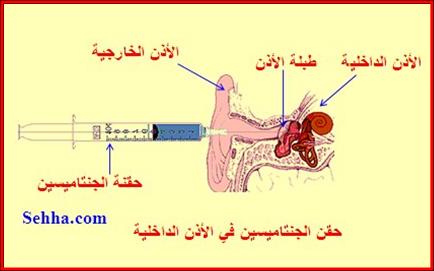 28143alsh3er.jpg