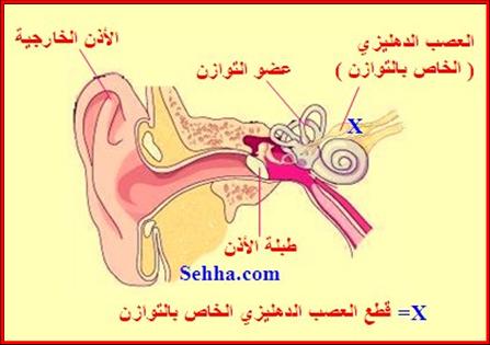 28144alsh3er.jpg