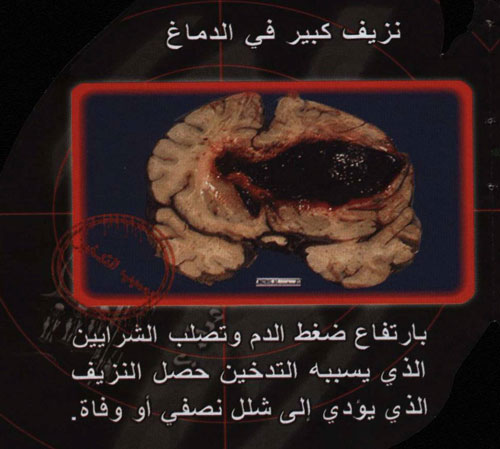 940.jpg