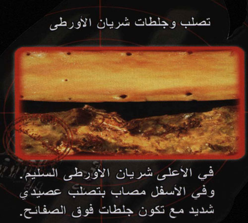 942.jpg