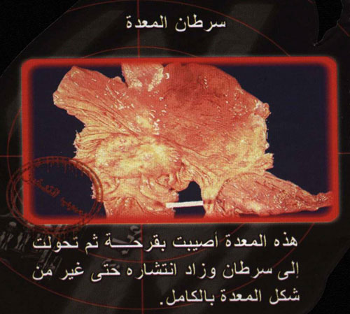 954.jpg