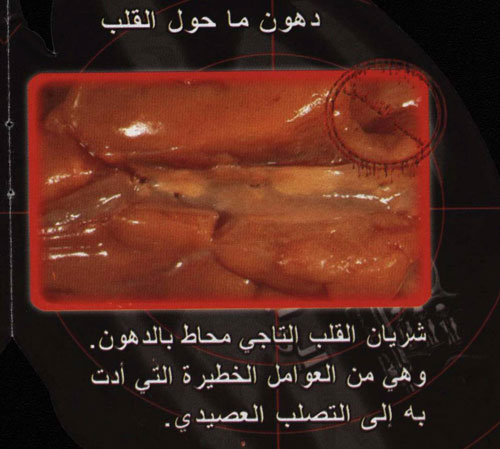 955.jpg