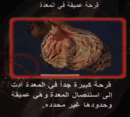 957.jpg
