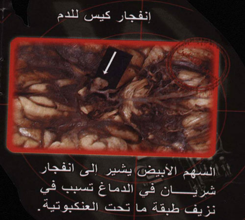 960.jpg